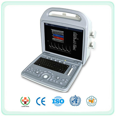 SV580 Full Digital Color Doppler Ultrasound